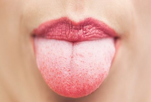 TONGUE-focus