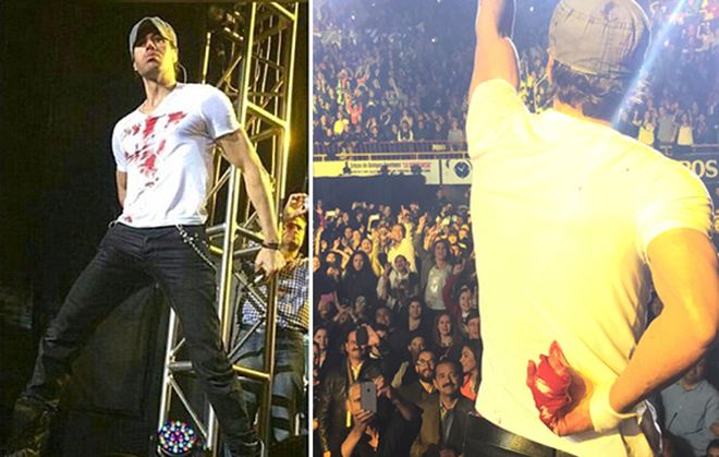 Φρικτό ατύχημα για τον Enrique Iglesias – Έκοψε τα δάχτυλά του σε συναυλία (ΦΩΤΟ)