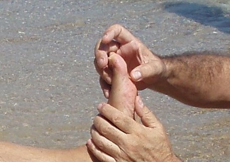 Τι κάνουμε αν πατήσουμε αχινό;