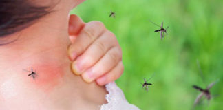 Αντιμετωπίστε τα τσιμπήματα των κουνουπιών με φυσικό τρόπο!