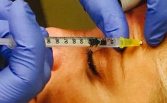 botox1-FOCUS