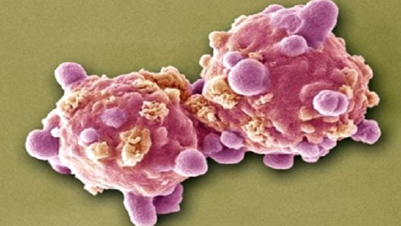 CANCER-focus