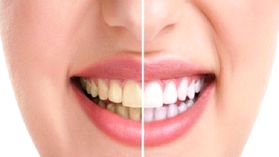 TEETH-focus