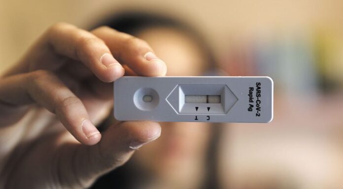 Ξεκινά από σήμερα η δωρεάν διάθεση των self test από τα φαρμακεία
